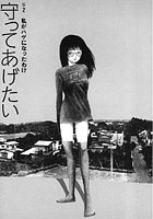 守ってあげたい(2)「守ってあげたい」#2私がハゲになったわけのイメージ画像