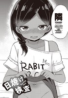 日焼け検査のイメージ画像